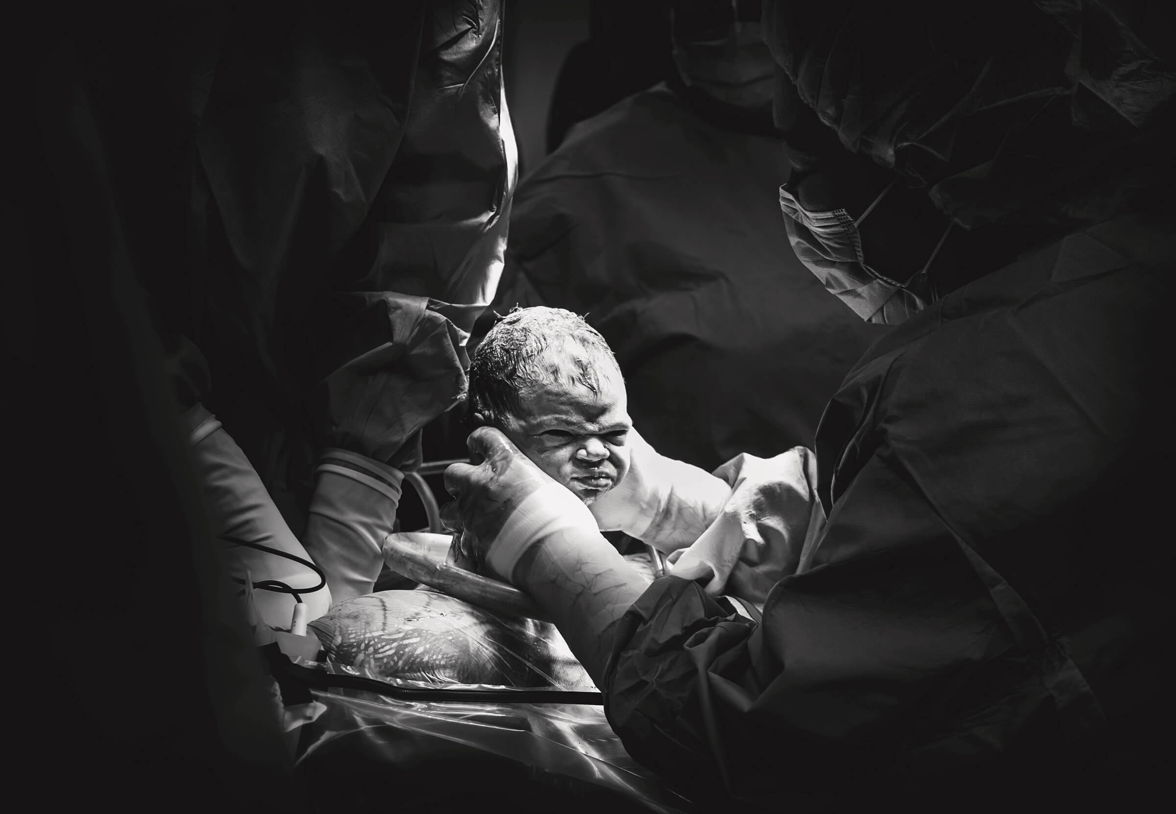 little loo photography at a c-section