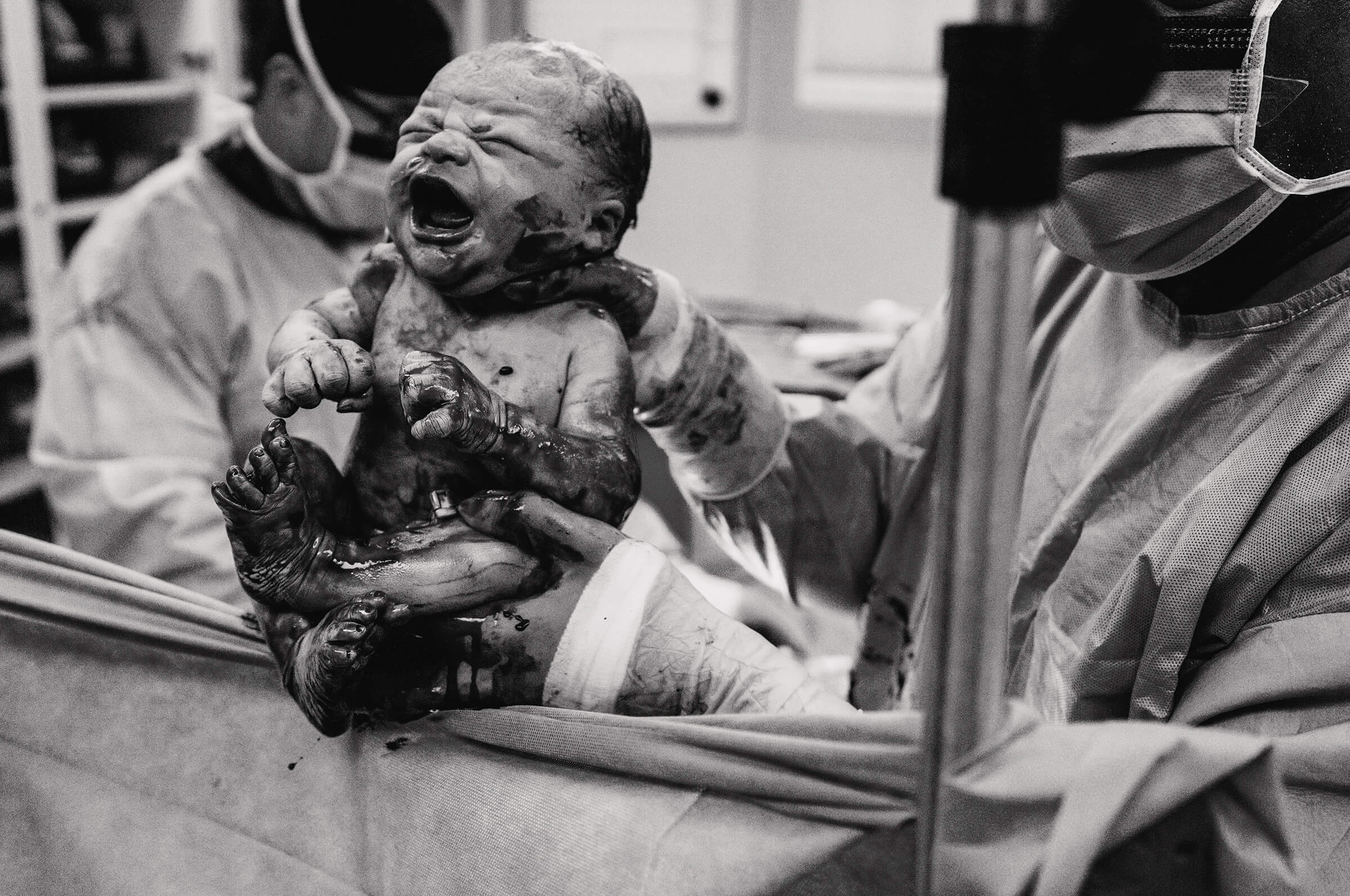 black and white image of a baby during a cesarean section being lifted over the drape