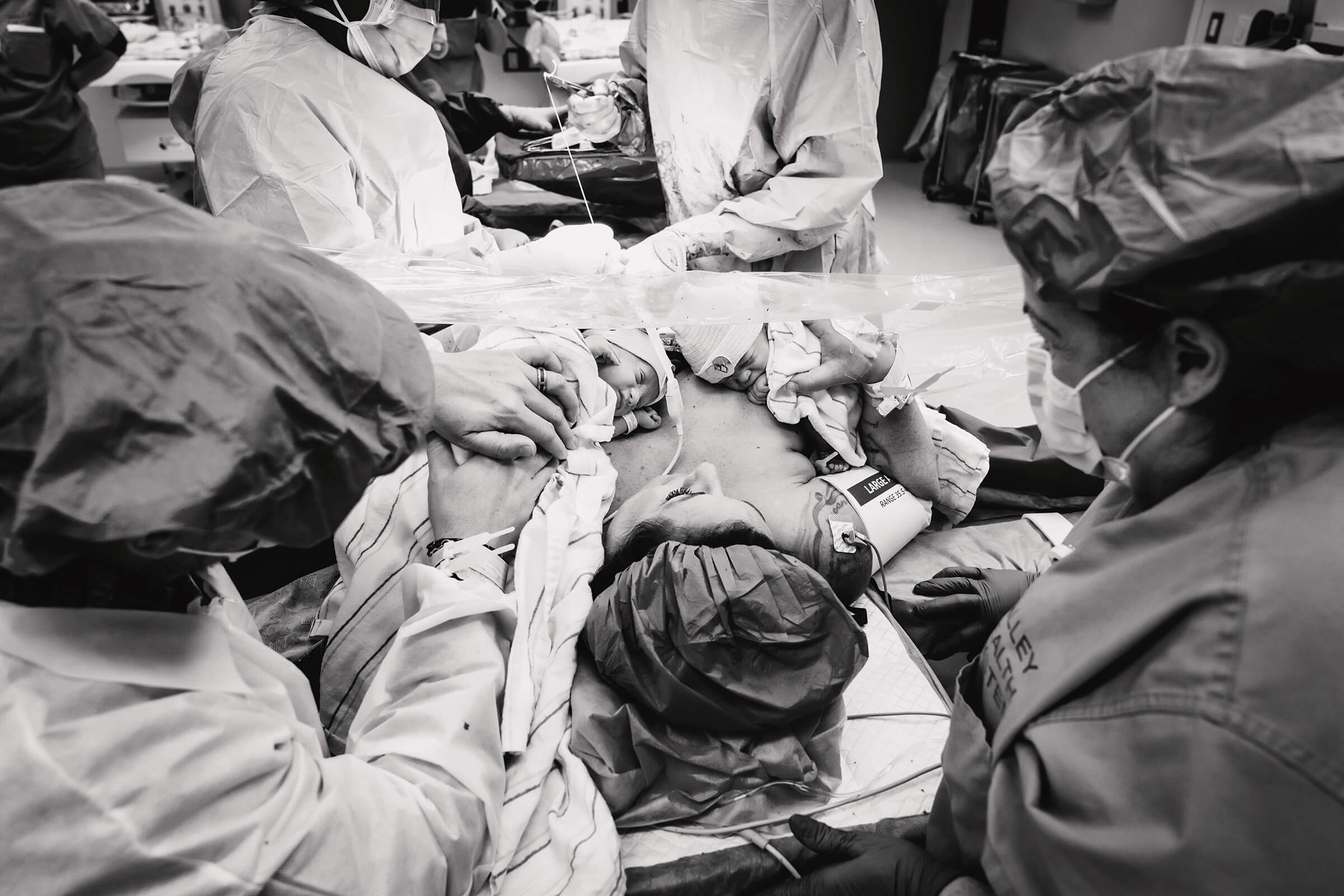 Gentle c-section with twins skin-to-skin
