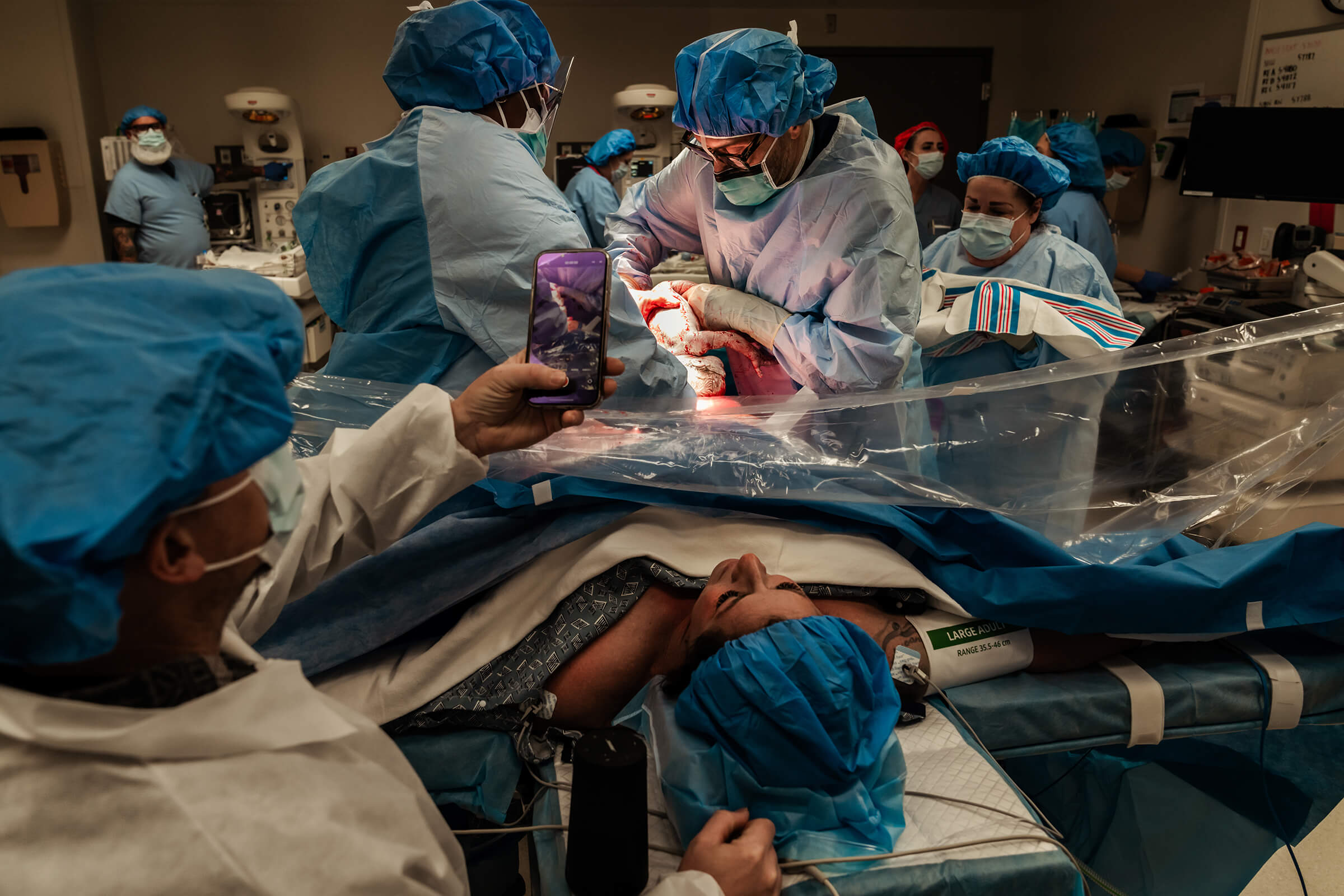 Dr Wilkes delivering breech twin via c-section at Summerlin Hospital