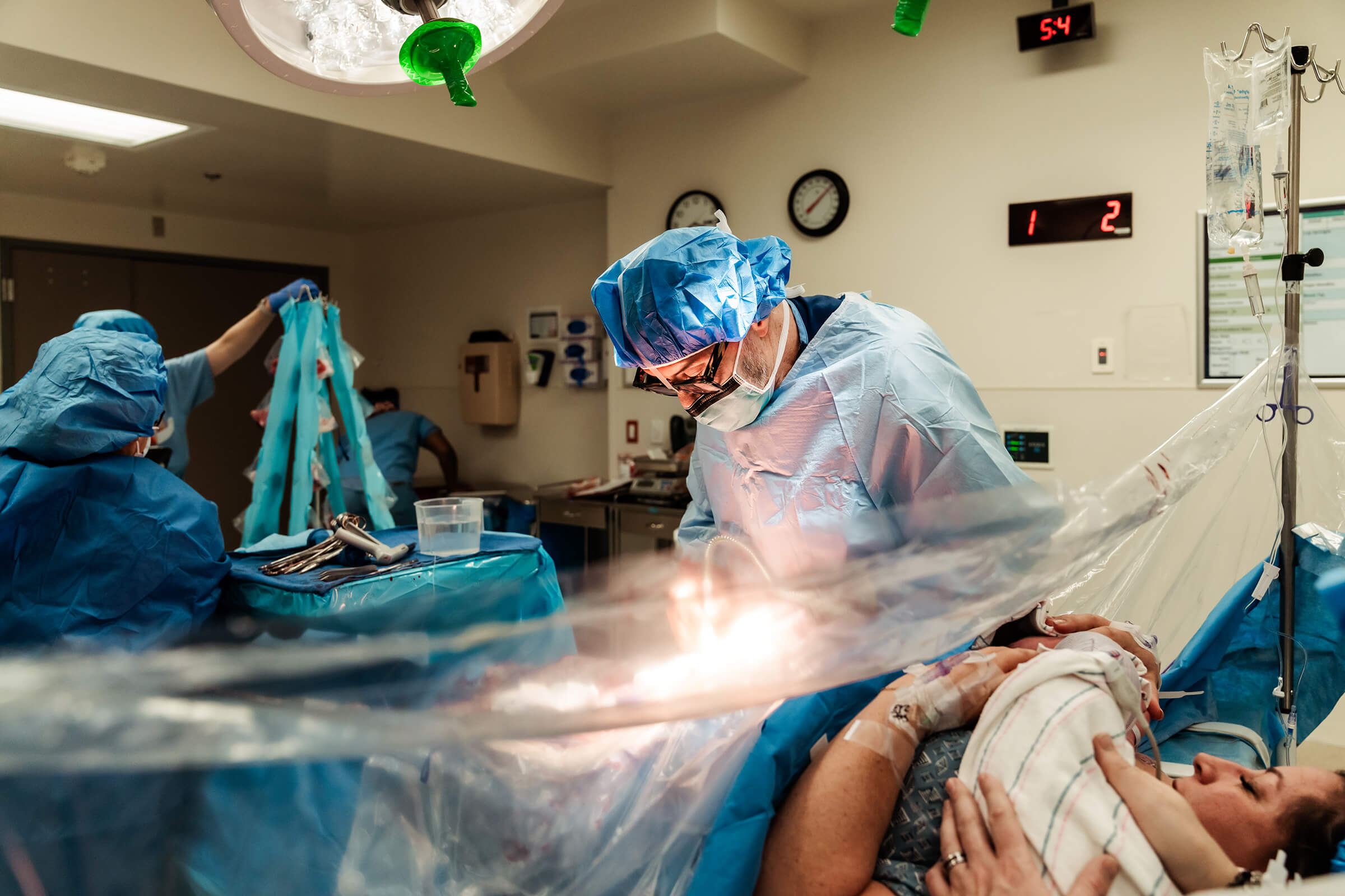 Closing of abdominal incision after a c-section