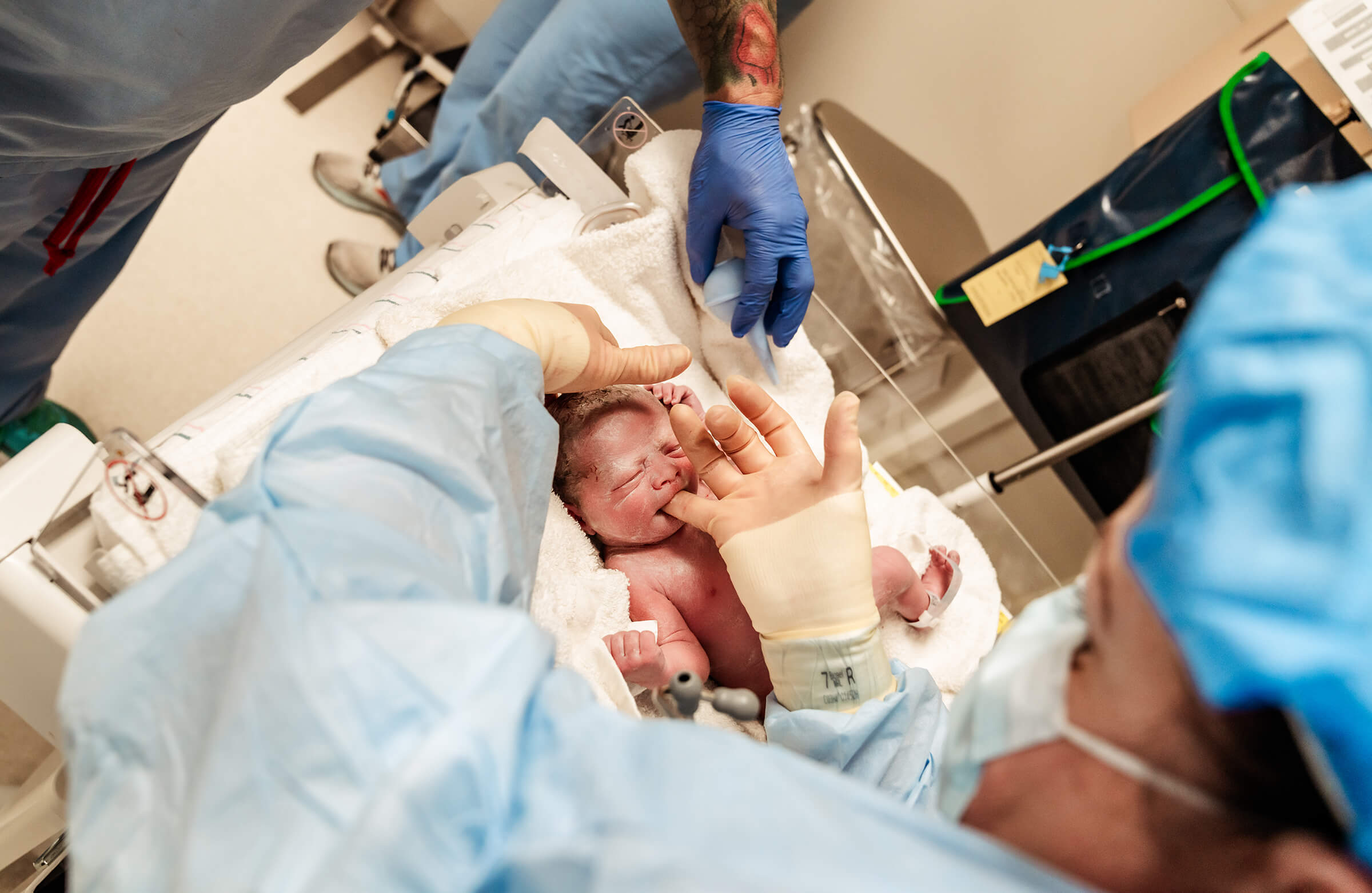newborn exam in the operating room after twin delivery